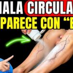 Cómo Cuidar las Piernas y Apoyar la Circulación Cuando Aparecen Várices: Un Enfoque Realista y Consciente