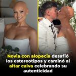 👩🦲BELLEZA SIN ARTIFICIOS: Una Novia Desafía los Estereotipos Tradicionales y Camina al Altar Celebrando su Autenticidad